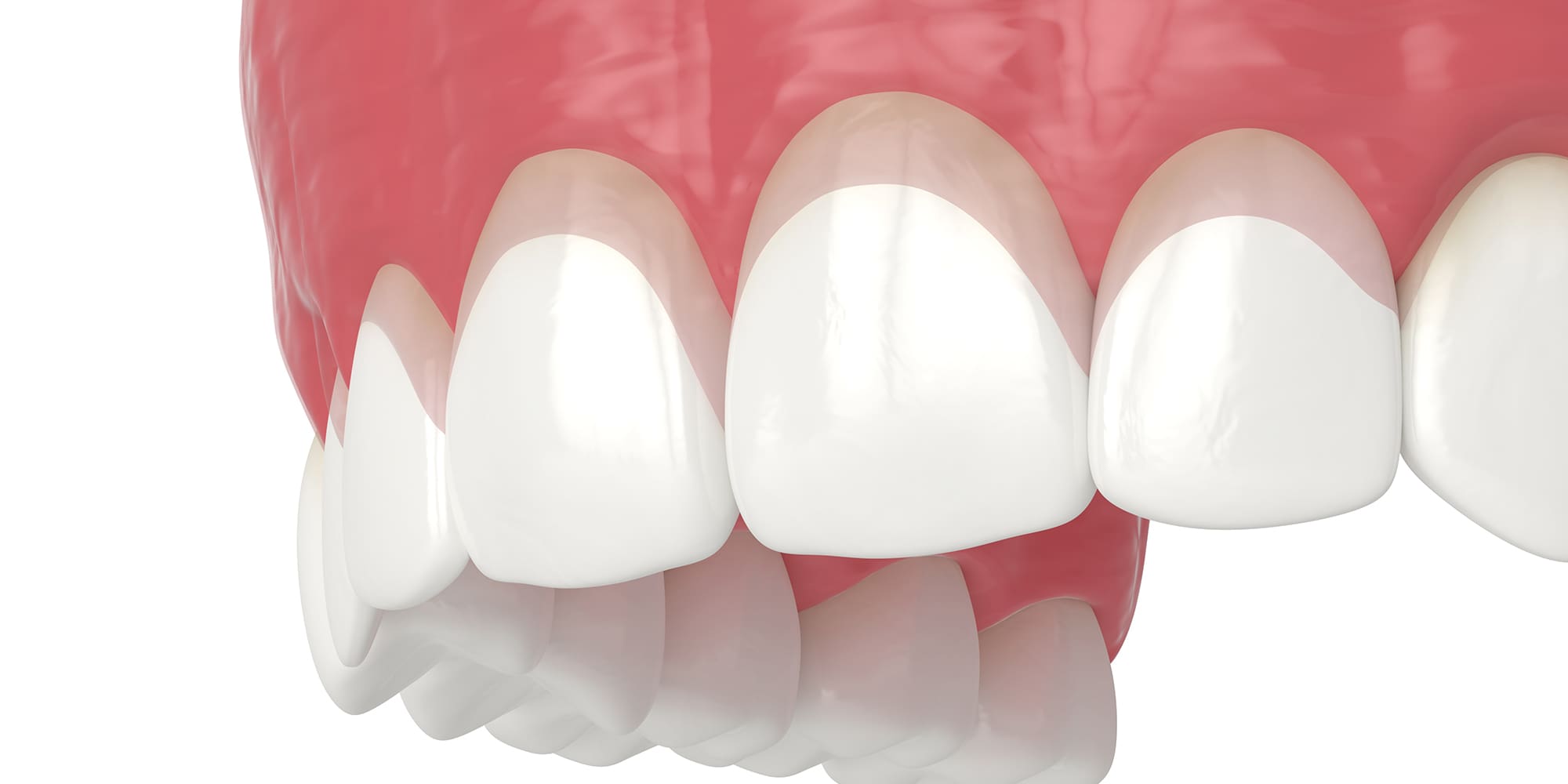 Periodontal Plastic Surgery