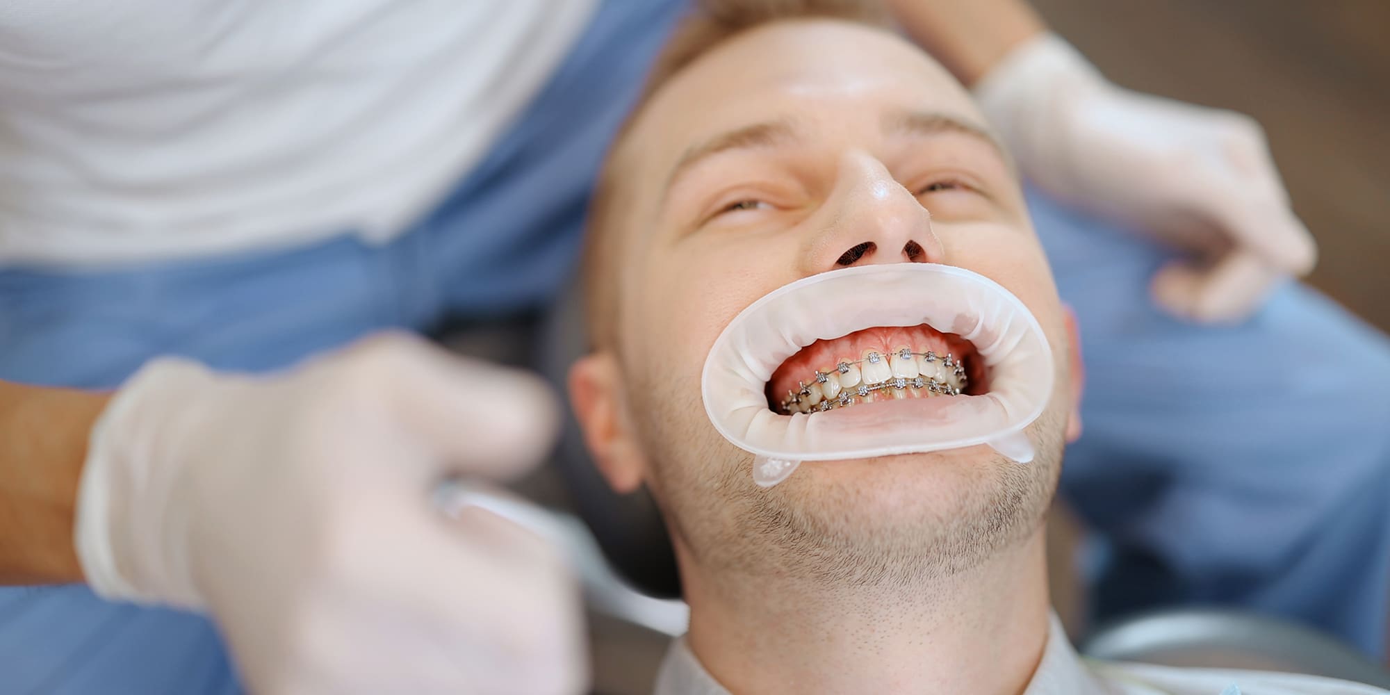 Surgically Facilitated Orthodontic Therapy (SFOT)