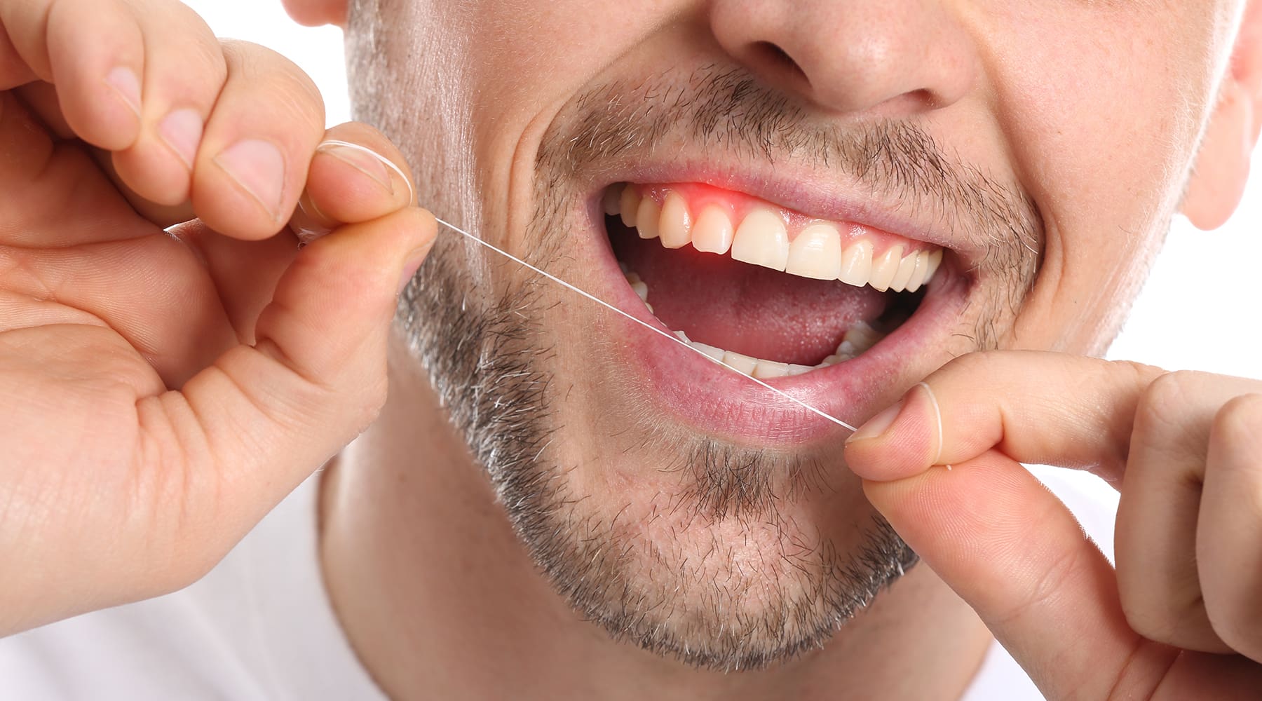 5 Reasons Your Gums Bleed When Flossing